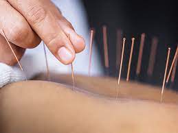 Acupuncture & Sound Bath - Friday October 25th - 7pm